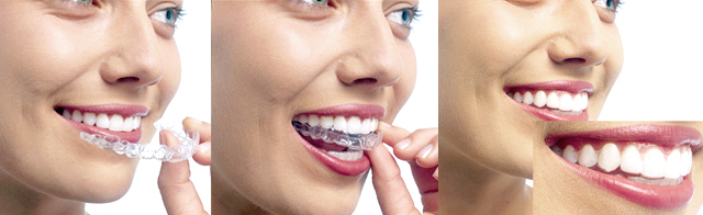 �}�E�X�s�[�X����